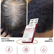 Andro-D Natural DHT Blocker