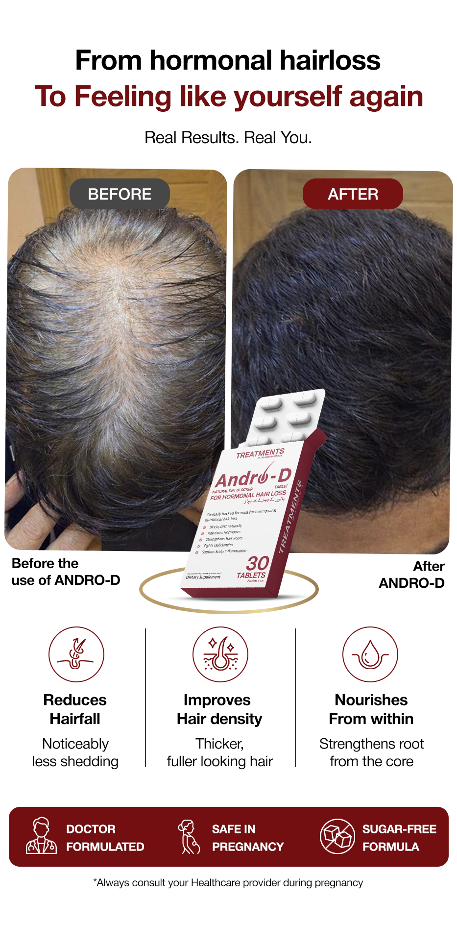 Andro-D Natural DHT Blocker