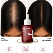 IROPRIME – Advanced Iron Drops for Rapid Absorption & Energy Recovery