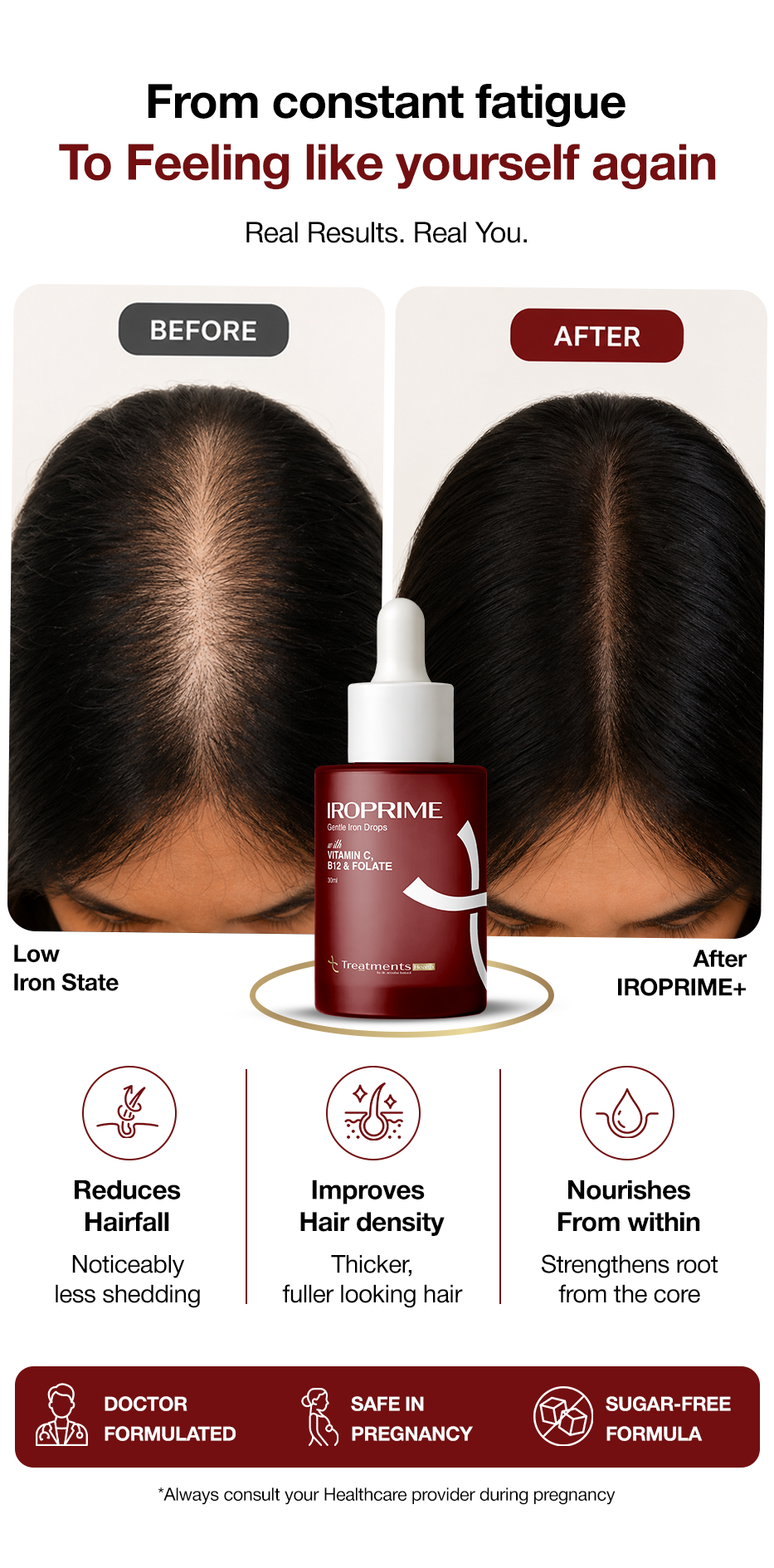 IROPRIME – Advanced Iron Drops for Rapid Absorption & Energy Recovery